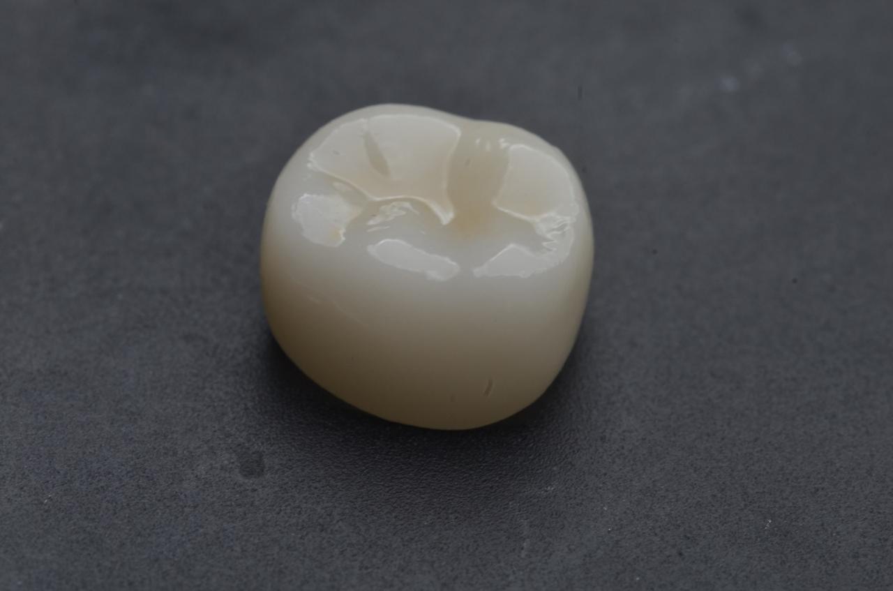 lower right second molar
